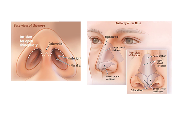 Egent Centers for Ear, Nose and throat. Rhinoplasty